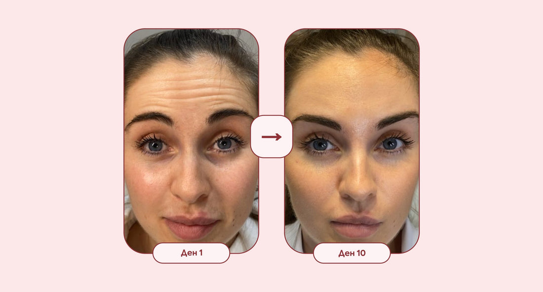 Изглаждане на бръчки и фини линии