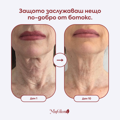 Пластири за шия